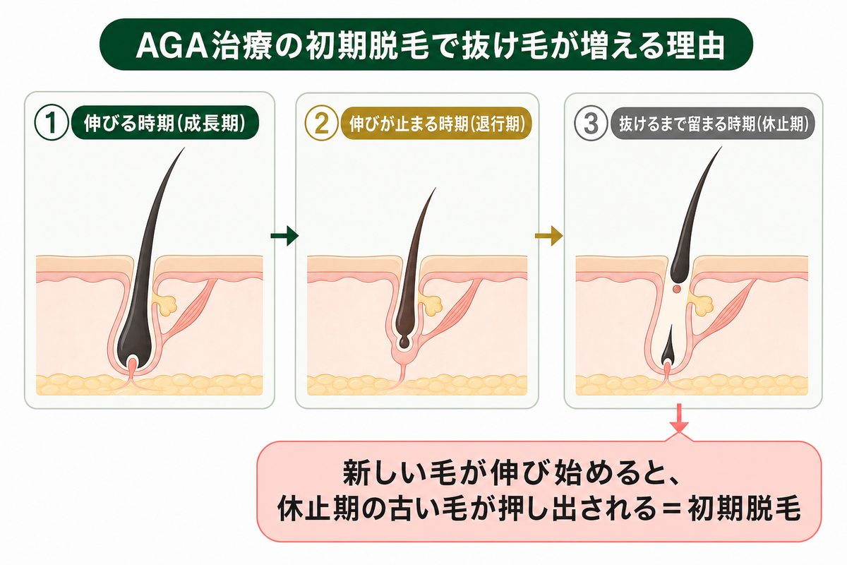 AGAオンライン診療の効果はいつから？治療開始後の経過