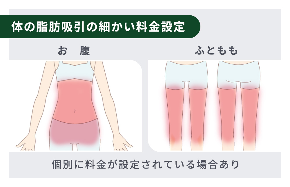 体の脂肪吸引の細かい料金設定について