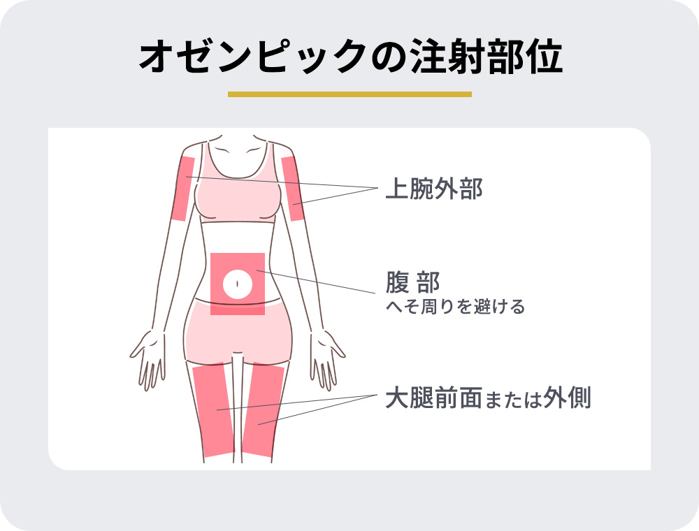オゼンピックの注射部位の図説